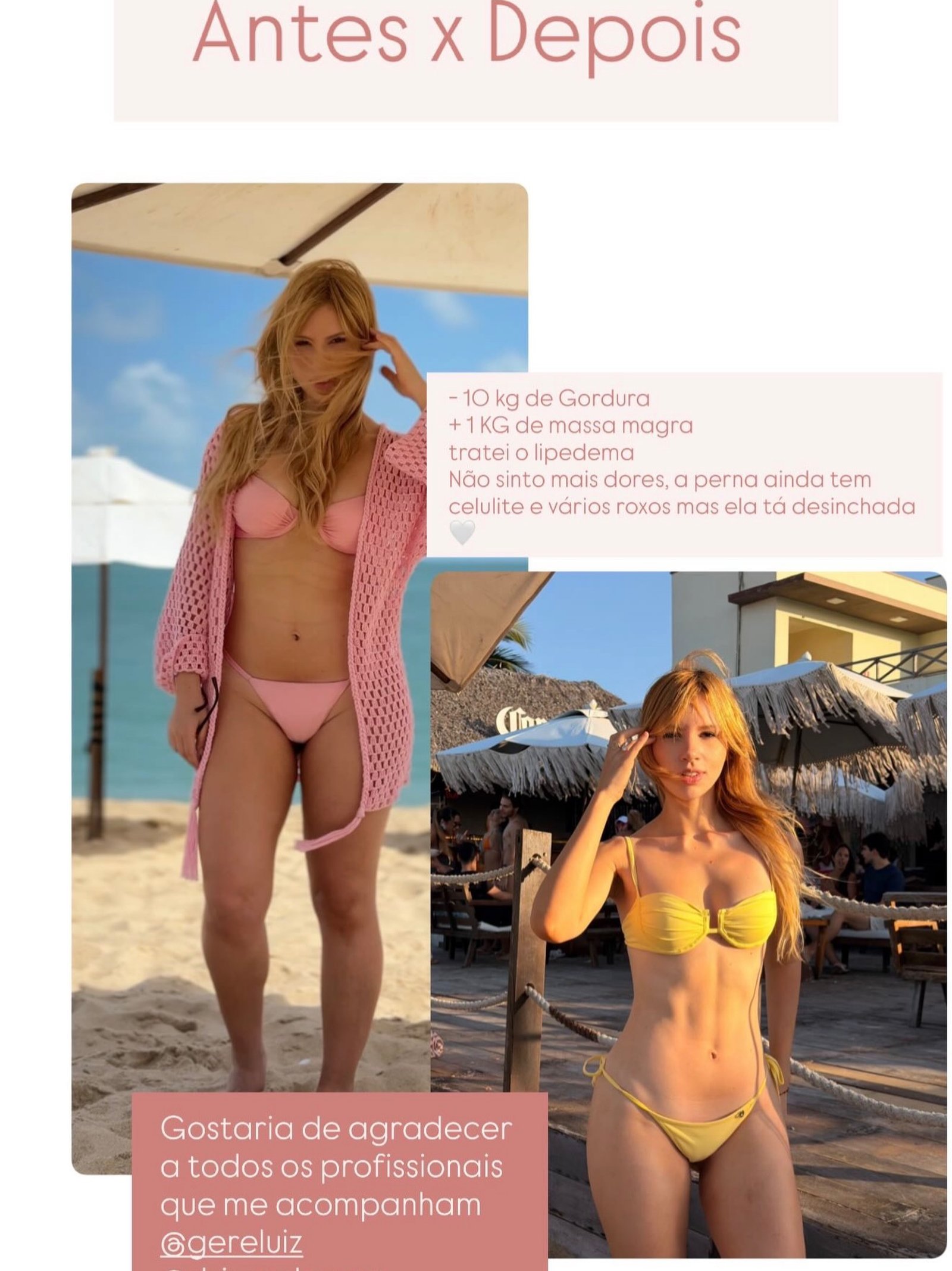 Tay Fernandes - antes e depois do tratamento